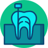 Root Canal Treatment